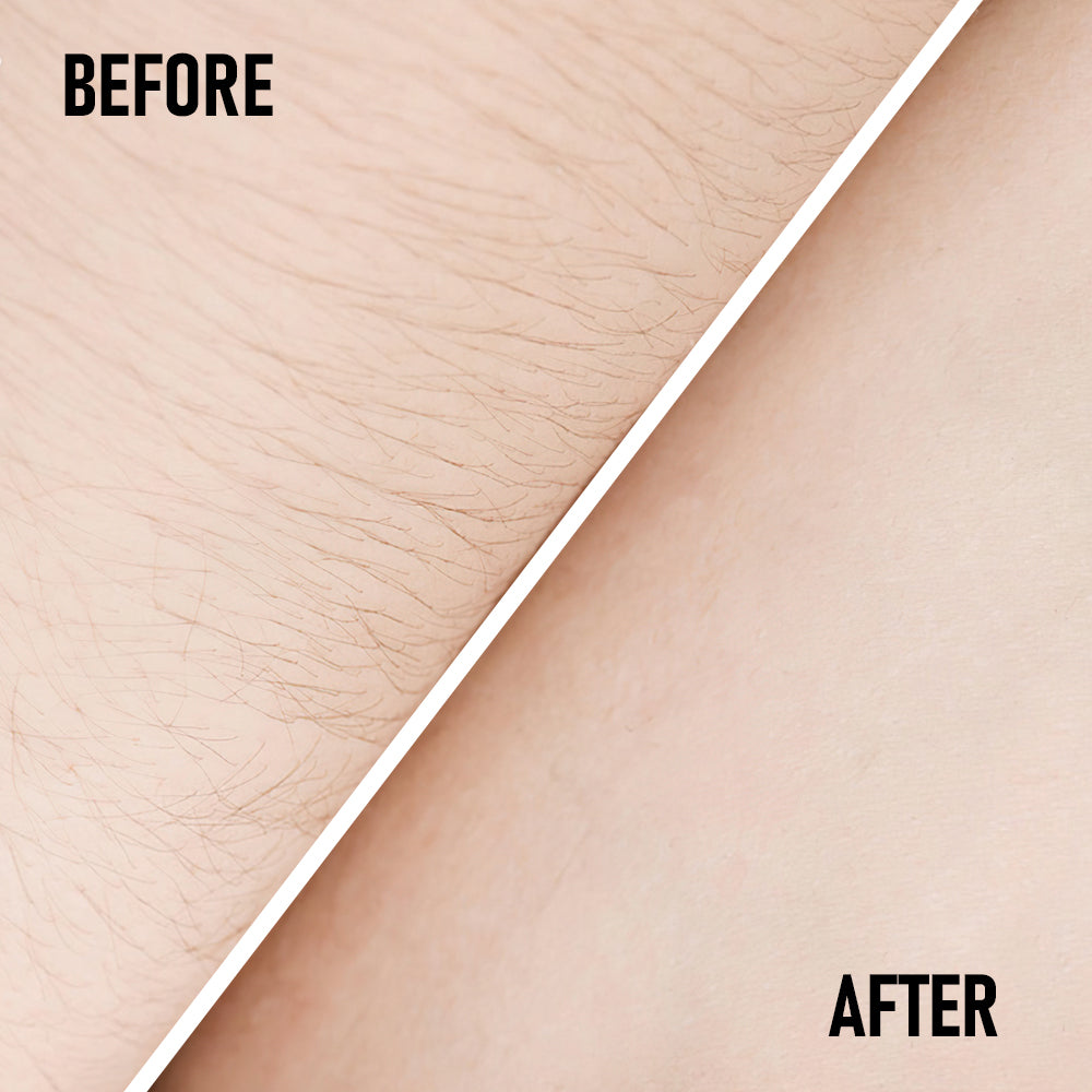 Phofay Pain Free Hair Removal Cream