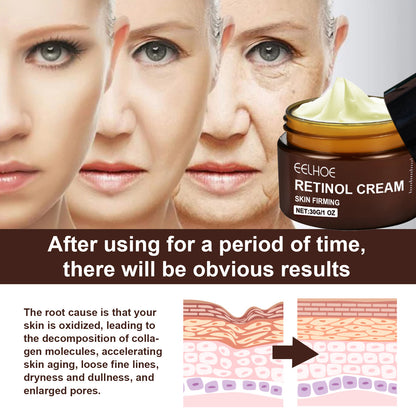 EELHOE Retinol Anti-Aging Face Cream