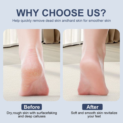Electric Rechargeable Foot Callus Remover
