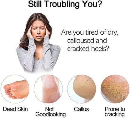 Electric Foot Grinder & Callus Remover