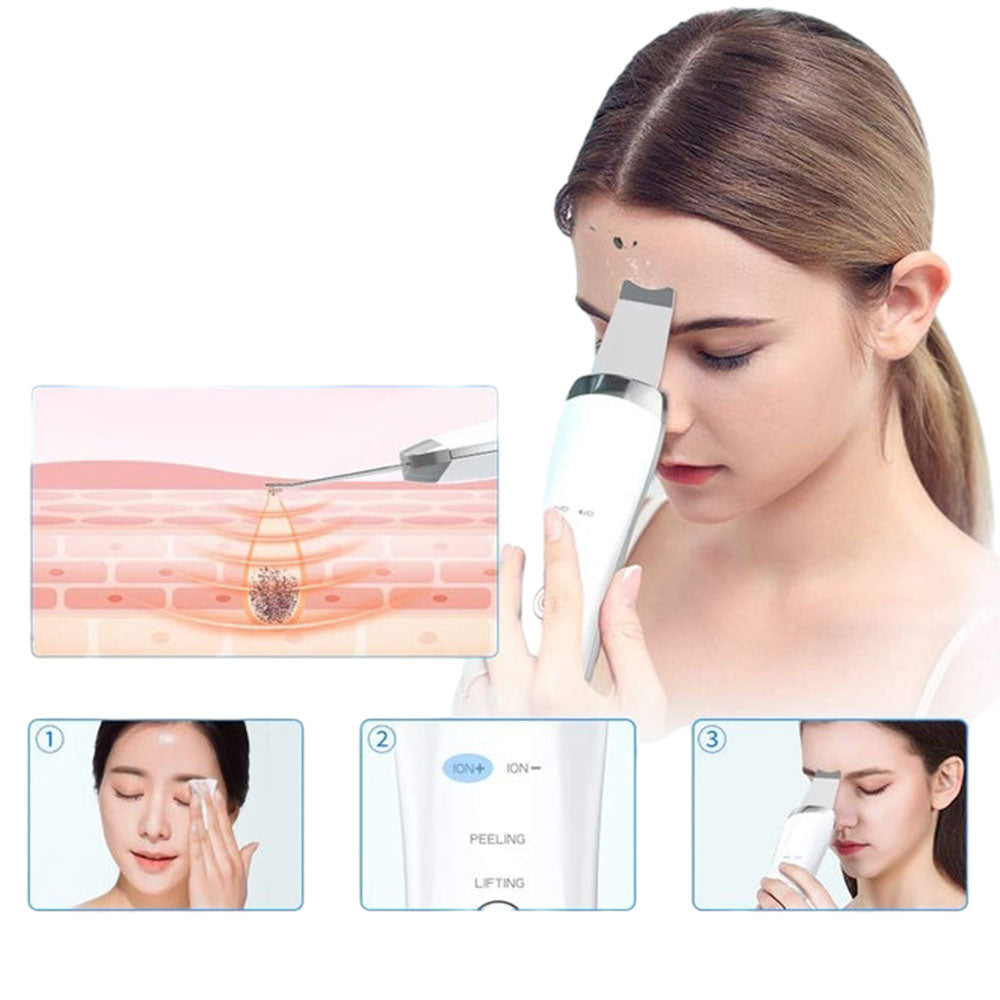 Electric Ultrasonic Facial Skin Scrubber