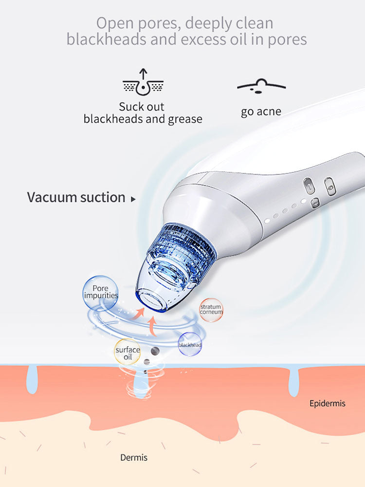 Electric Blackhead Suction Removal Tool