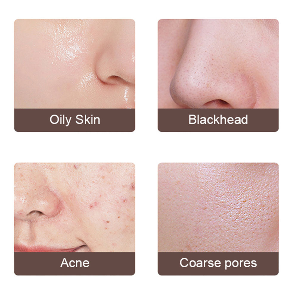 Electric Ultrasonic Facial Skin Scrubber